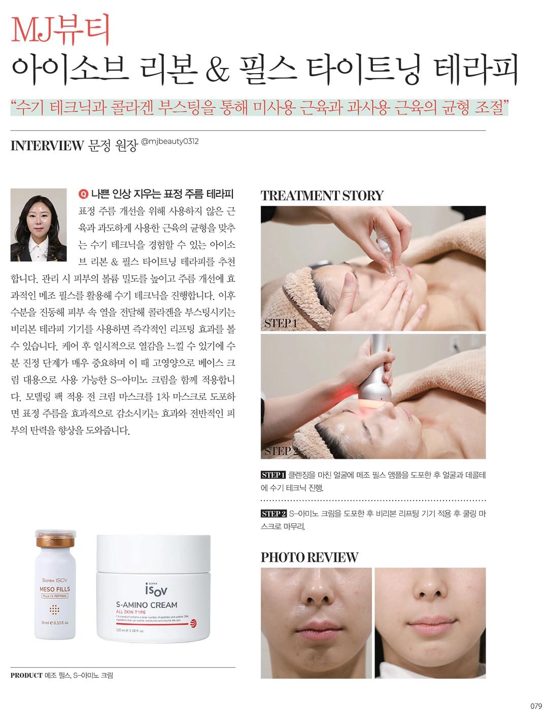 MJ Güzellik: ISOV Ribbon & Fils Sıkılaştırma Terapisi