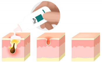 TC SPOT SOLUTION 32ml