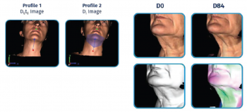 INTENSIVE NECK CARE KIT