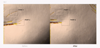 INTENSIVE EYE CARE KIT