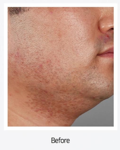 ETHOSOME DDS ASTAXANTHIN BOOSTER 5ml×5ea