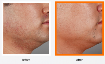 ETHOSOME DDS ASTAXANTHIN BOOSTER 5ml×5ea